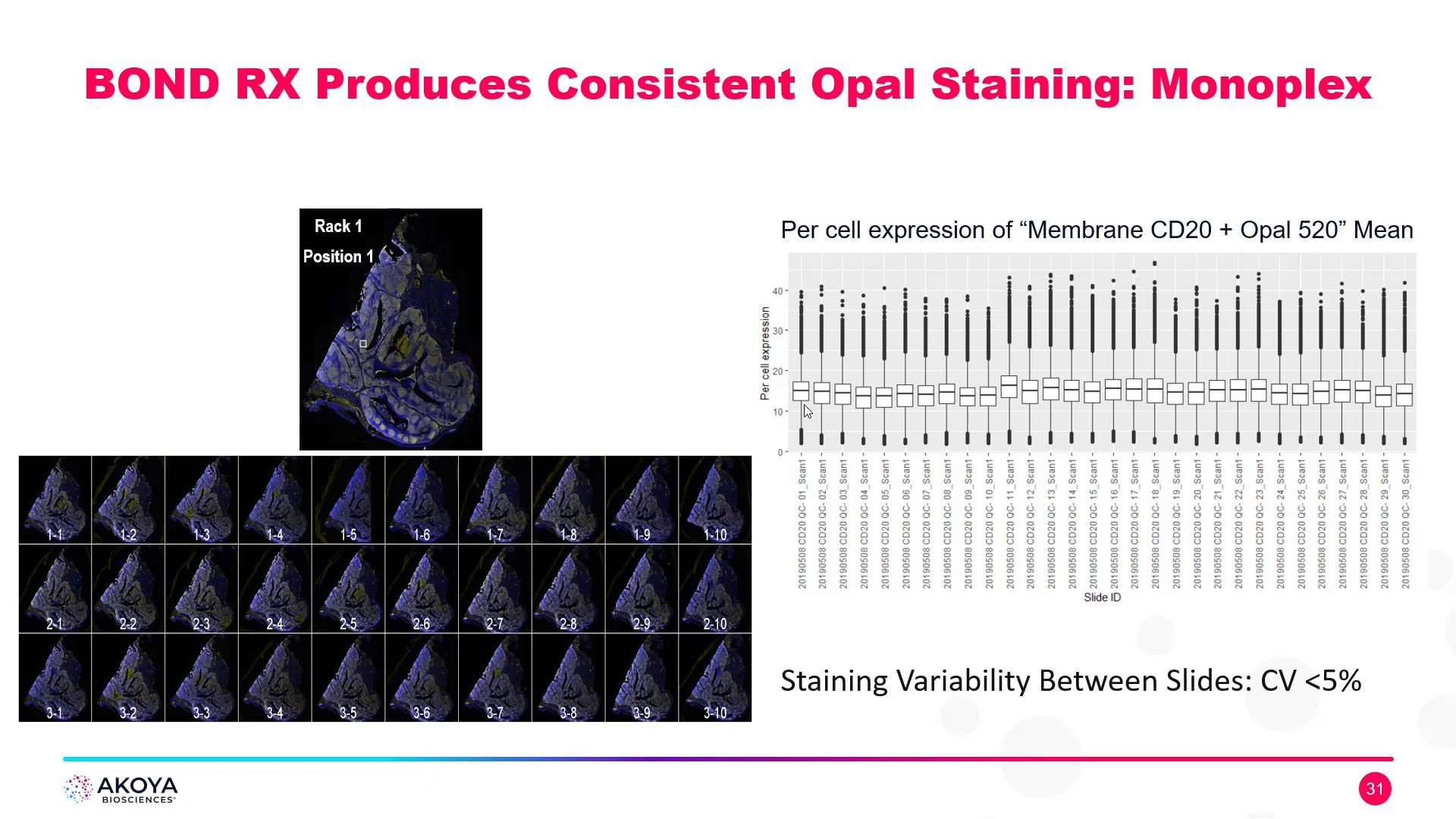 video-making-7-color-multiplex-fluorescent-ihc-a-breeze-the-new-fully-optimized-opal-motif-pd1-pd-l1-panel-kits-for-lung-cancer-and-melanoma-on-the-bond-rx