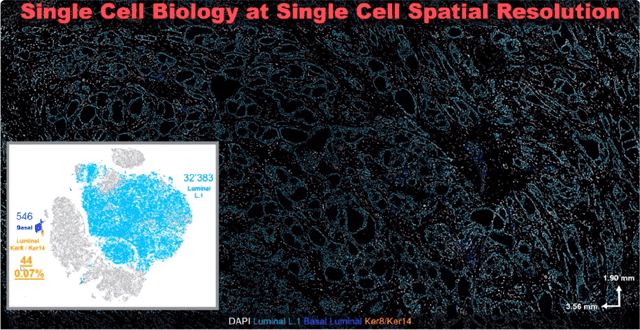 Thumbnail Mar 26 CODEX Breast Cancer FFPE Webinar