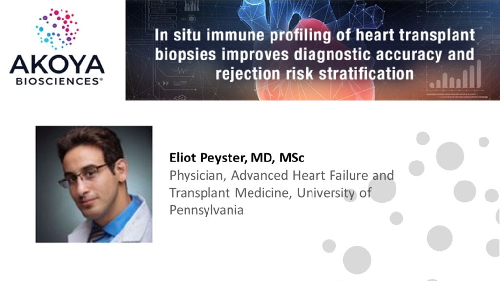 Cardiac Transplant Webinar