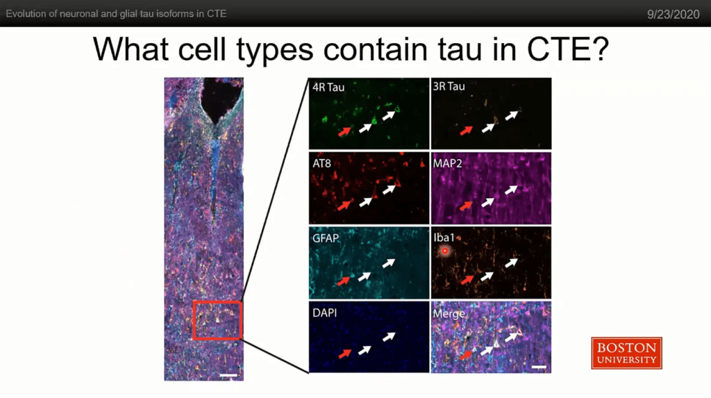 webinar thumbnail wrum CTE evolution 2