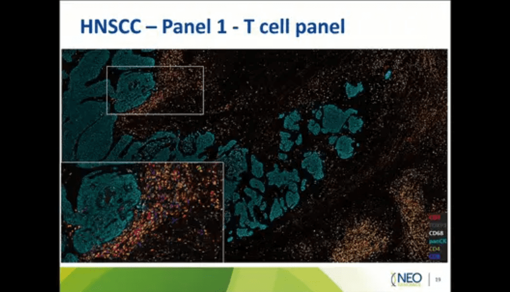 webinar thumbnail wrum neogenomics 2