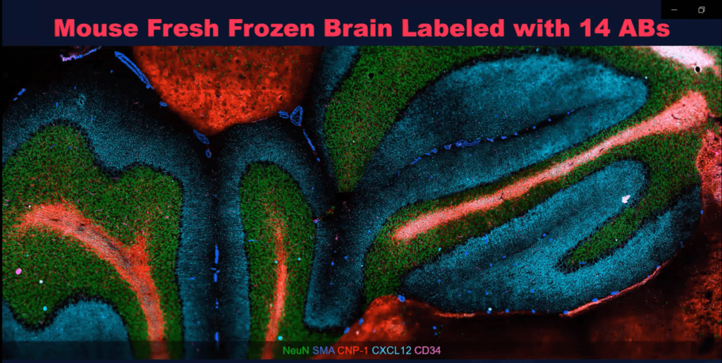 Thumbnail Picture for Neuro Showcase v1