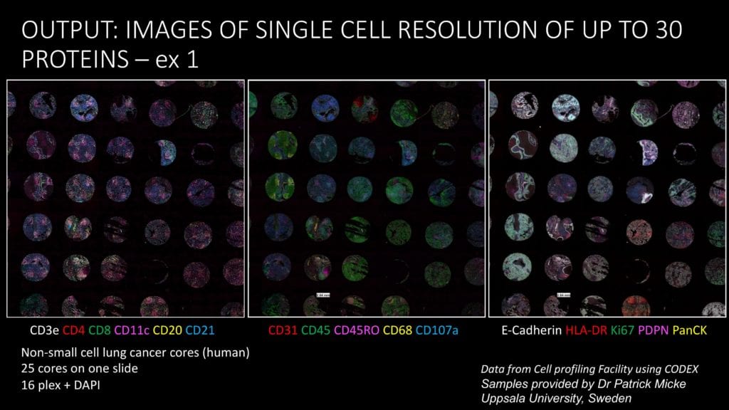 Images of single-cell resolution of up to 30 proteins. Non-small cell lung cancer cores (human). 25 cores on one slide. Data from Cell Profiling Facility using CODEX. Samples provided by Dr. Patrick Micke, Uppsala University, Sweden.
