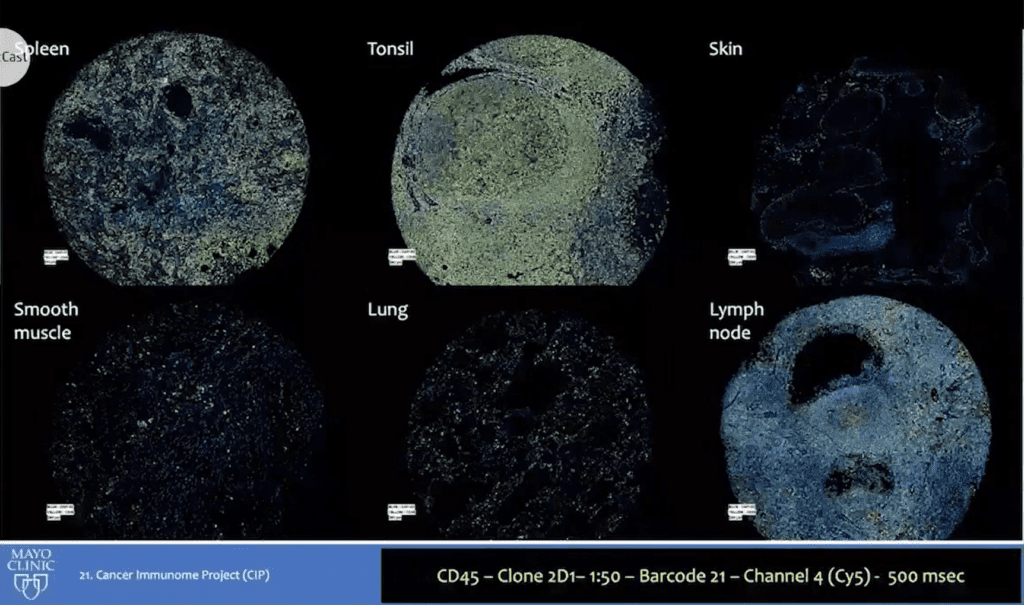 webinar thumbnail jcvillasboas immunome