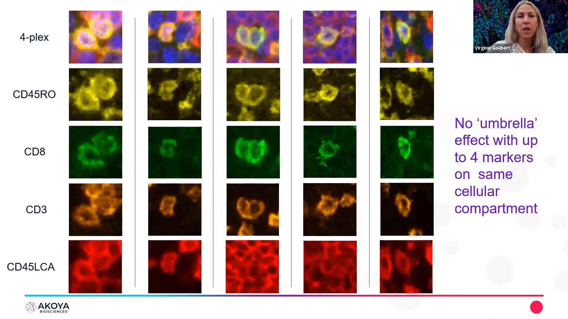 video-spatial-phenotyping-with-opal-from-manual-to-automated-multiplex-staining