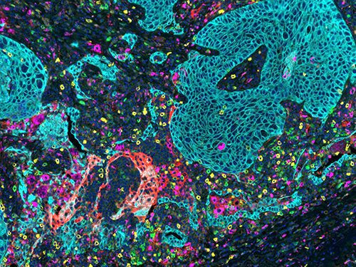 LungImageOpal7Color 1 2