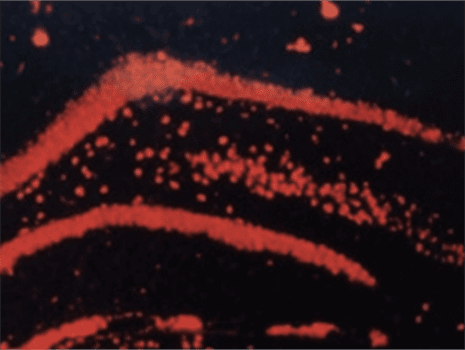TSA TMR image 2