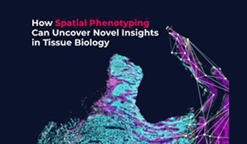 spatial case study1