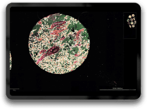 data Placenta