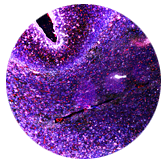 thumbnail HumanBrain