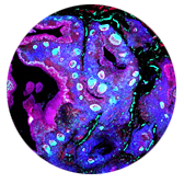 thumbnail Tonsil