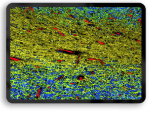 data Cerebellum
