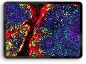data tonsil2