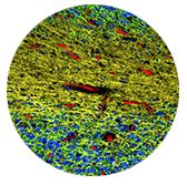 thumbnail Cerebellum