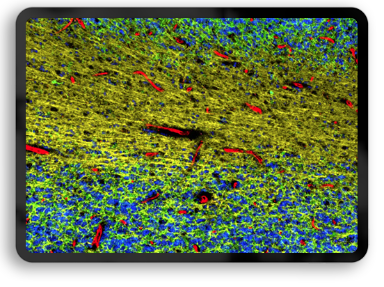 data Cerebellum 384