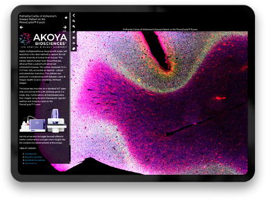 data brain 384