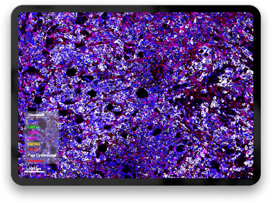 data squamous 384