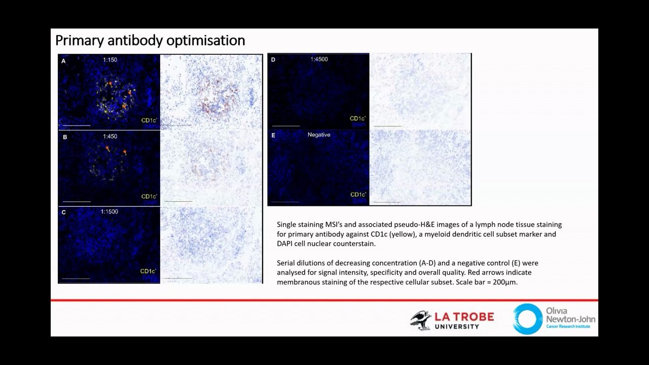 video-AU-spatial2023-Tertiary-Lymphoid-Structures