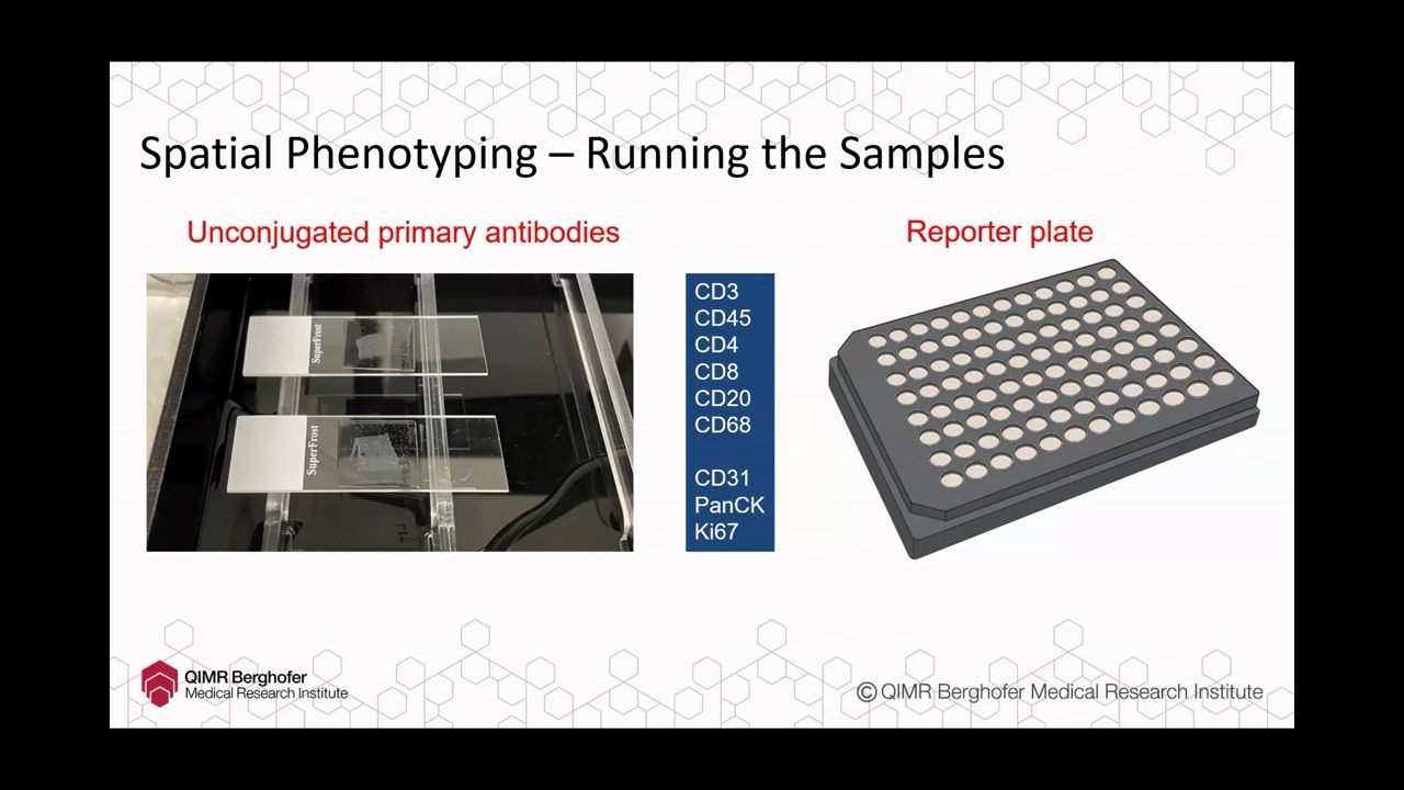 video-AU-spatial2023-spatial-imaging-and-phenotypic-analysis-of-immune-cells-and-malaria-parasites-in-plasmodium-infected-human-spleens