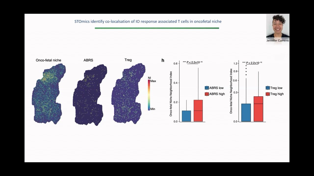 video-AU-spatial2023-spatial-precision-oncology-stratifying-immunotherapy-response-in-hepatocellular-carcinoma