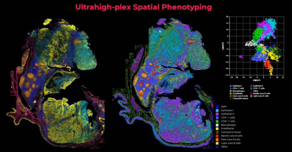 Webinar Watch Now Spatial Phenotyping A Revolutionary Approach to Biomarker Discovery for Cancer Immunotherapy