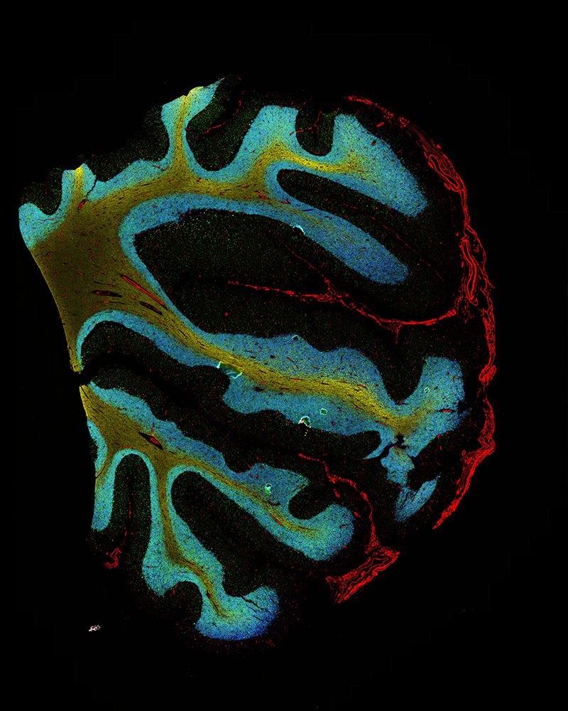 phenocycler instrument Cerebellum