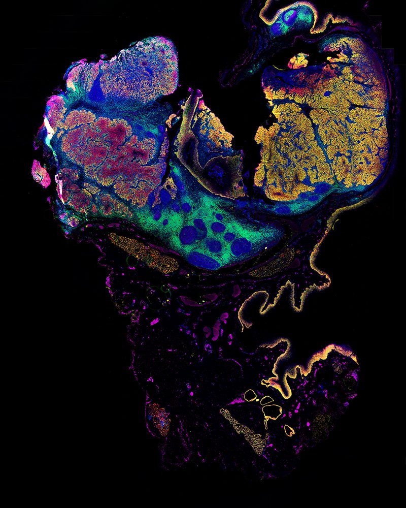 phenocycler instrument head neck