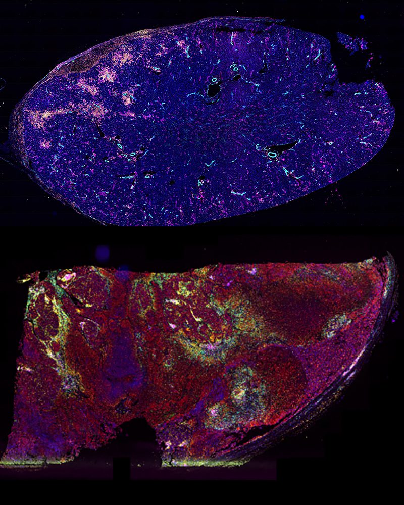 phenocycler instrument skin lung
