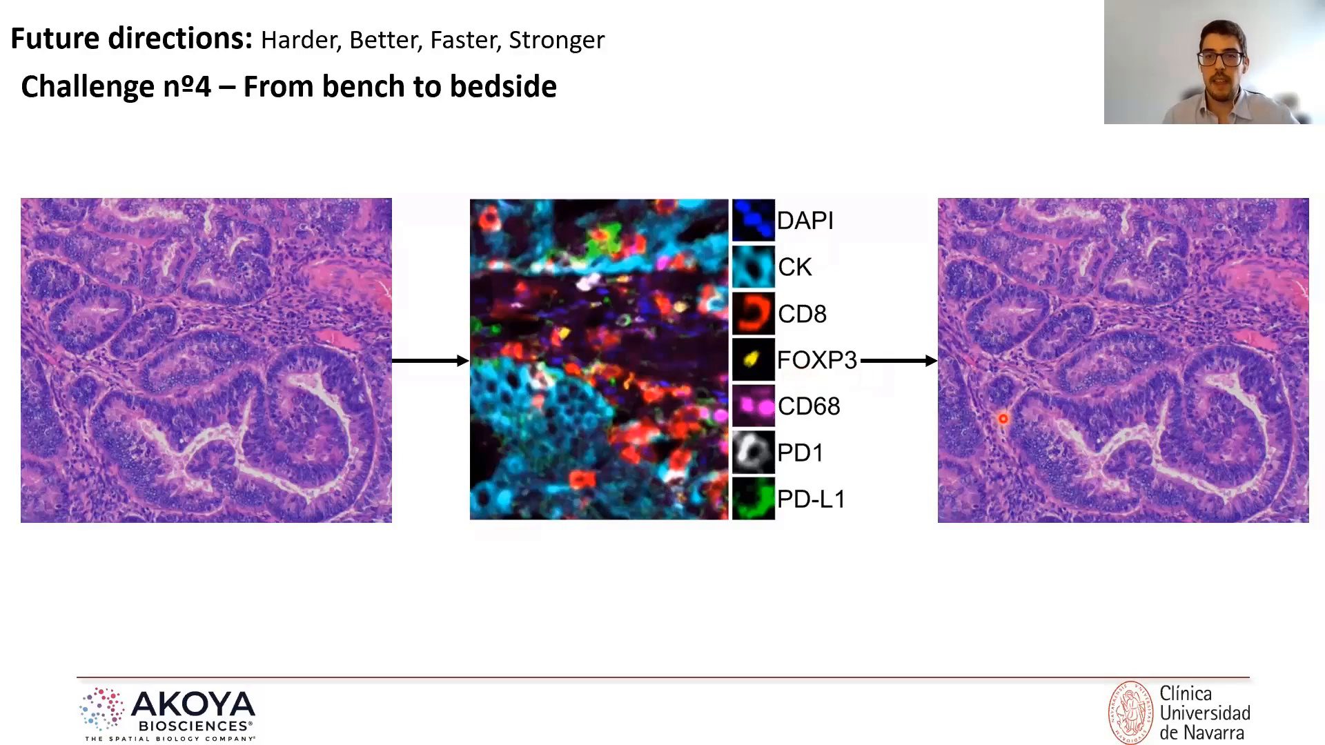 video-beyond-cell-densities-spatially-resolved-methods-to-analyze-tumor-immune-microenvironment-from-multiplex-immunofluorescence-images