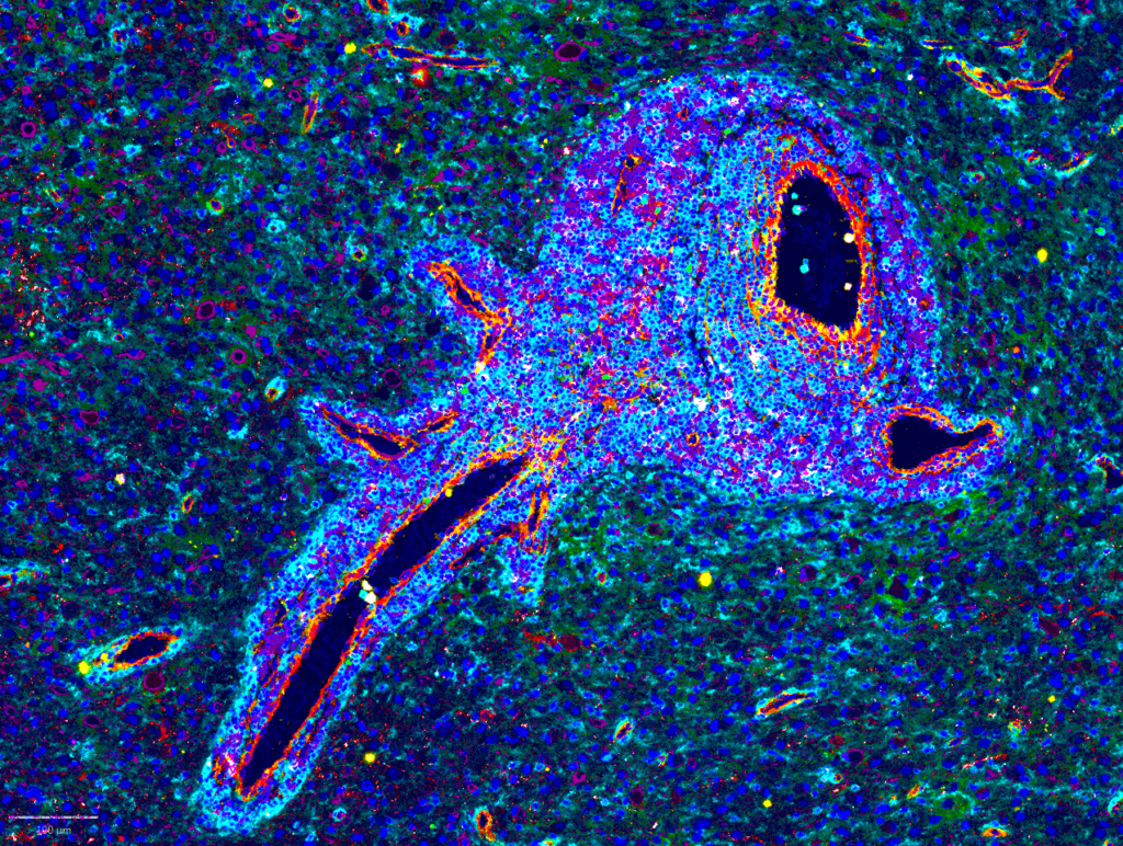 2024 Tissue Image Contest 46 Perivascular niche in human glioblastom 1