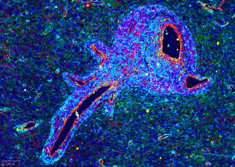 2024 Tissue Image Contest 46 Perivascular niche in human glioblastom 768x579 image