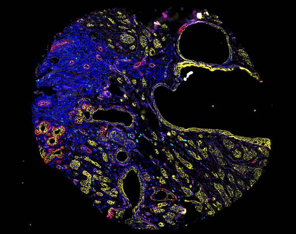 2024 Tissue Image Contest 52 Tissue microarray human breast cancer sample 1024x1024 @2x image