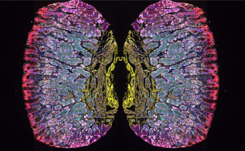 2024 Tissue Image Contest 63 Two mirror images of a healthy human stomach tissue microarray 1024x489 image