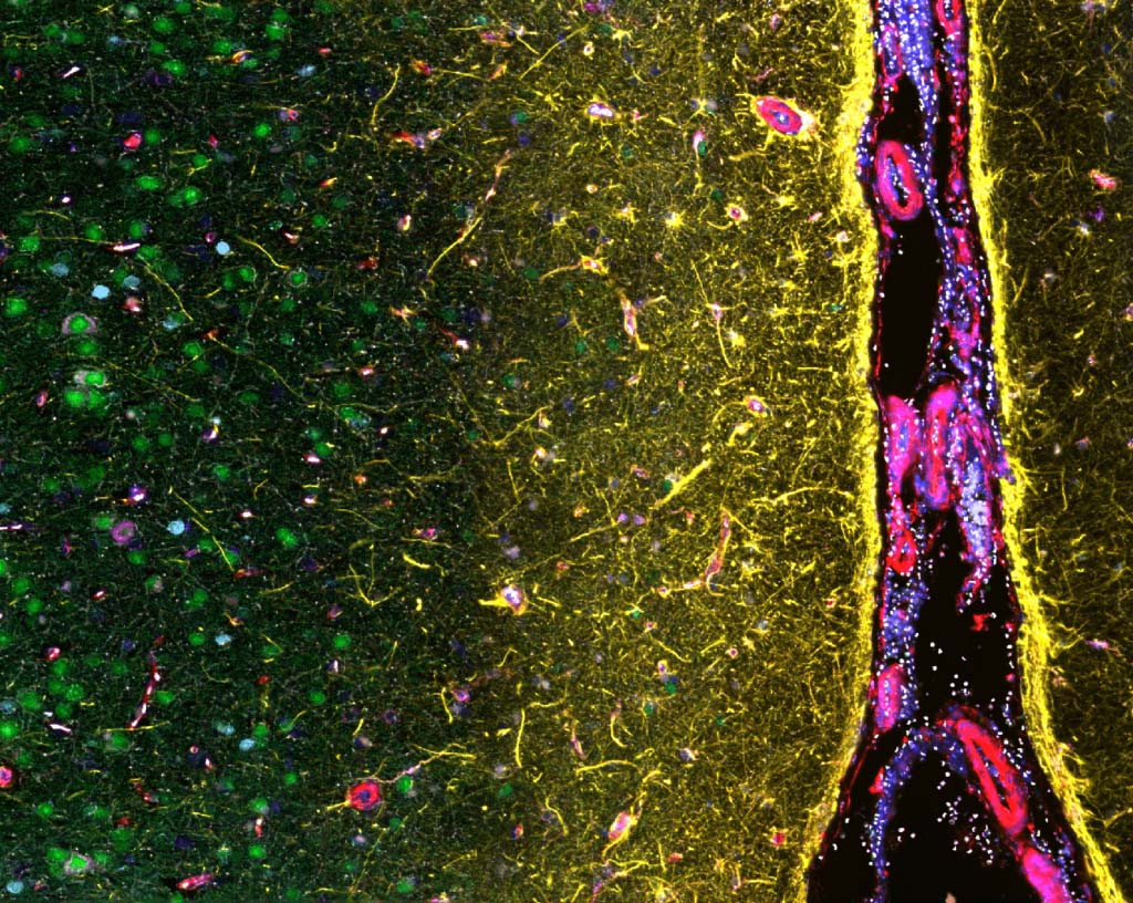 2024 Tissue Image Contest 7 Human brain FFPE multiplex on PhenoCycler Fusion 1024x816 @2x image