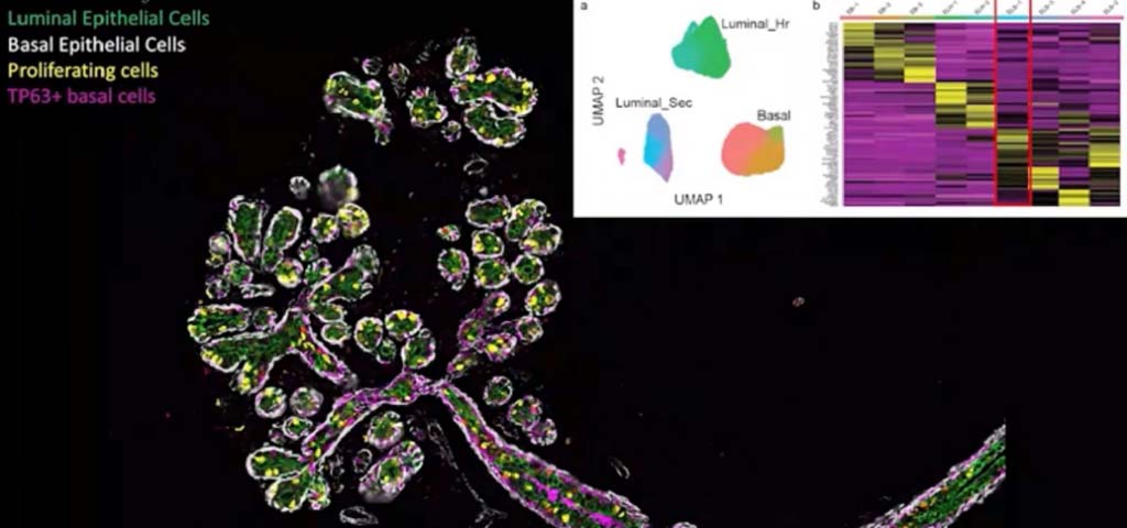 Human breast cell atlas webinar @2x image