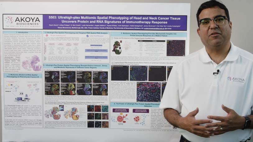 New Multiomic Spatial Phenotyping Approach Sheds Light on Immunotherapy Response Mechanisms image