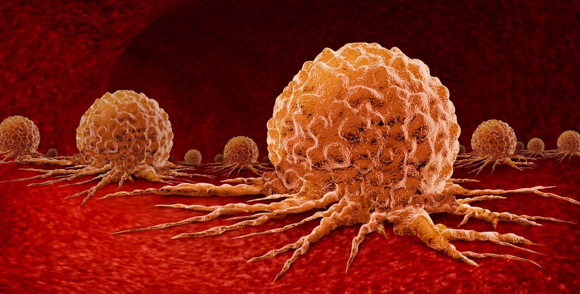Revealing the Role of Macrophage Subpopulations in Predicting Clinical Outcomes in Cancer compressed img