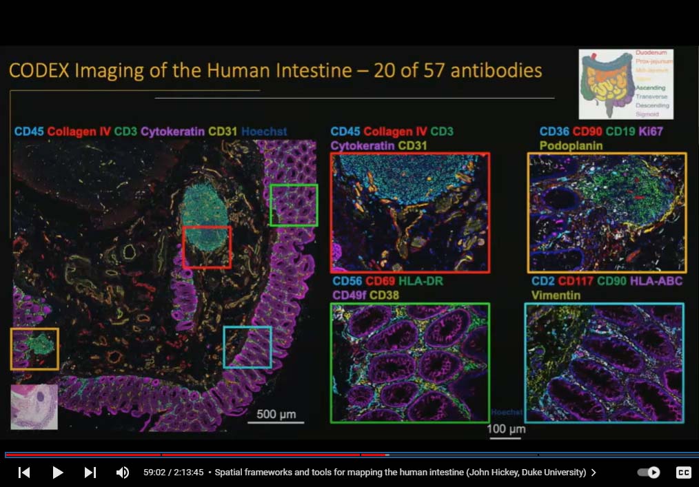 Spatial frameworks and tools for mapping the human intestina John Hickey image