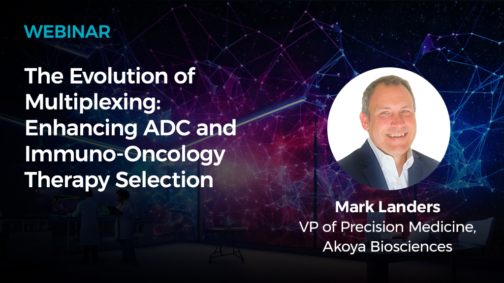 Webinar Spatial Insights Driving Drug Discovery 2025015
