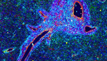 2024-Tissue-Image-Contest-46-Perivascular-niche-in-human-glioblastom-@2x