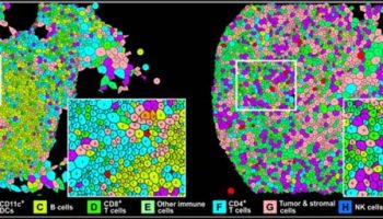 Neighborhood-Structures-in-CLR-Patients-@2x