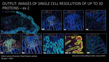Images of single-cell resolution of up to 30 proteins in human fresh-frozen sections of colorectal cancer. Data from the Cell Profiling Facility using CODEX.