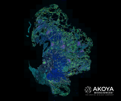 Tissue-image-lung-1