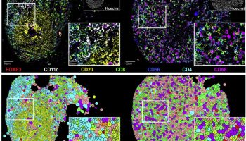 cell-neighborhoods-crc-tmas-1024x814