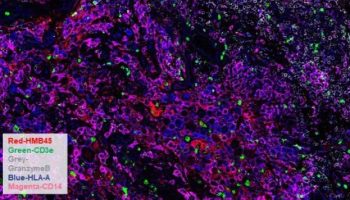 human-ffpe-melanoma-codex@2x-image