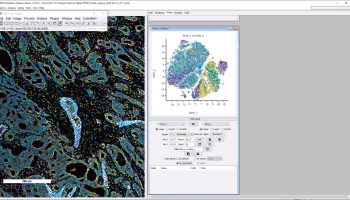 mav-tsne-breast-cancer-@2x-image