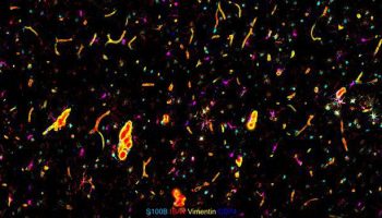phenocycler-alzheimers-4