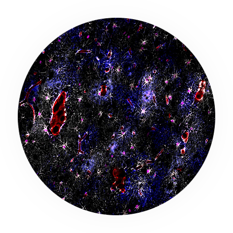 img Astroglia