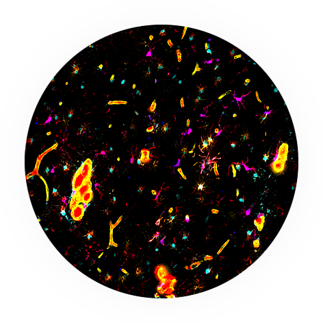 img Microglia