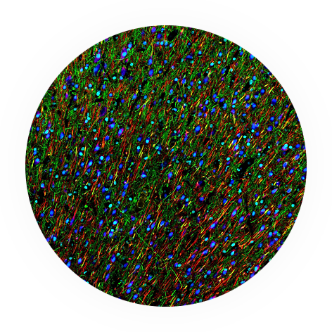 img Neurons